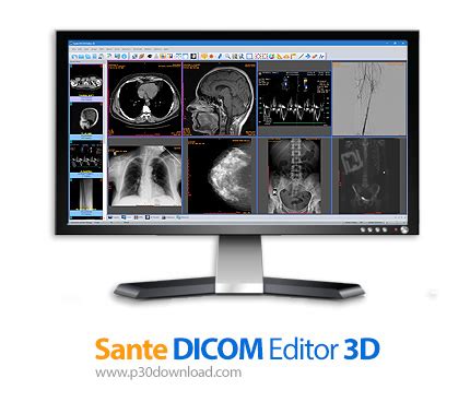 SeePlus DICOM 9.0 Download